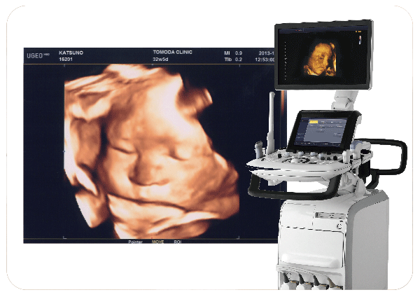 4Dエコー（2台）